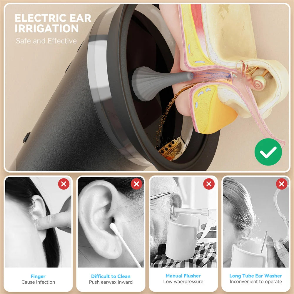 Gentle Clean™ Ear System.