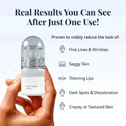 Youthful Rediance - Microneedle Infusion Kit - At Home Glow Set